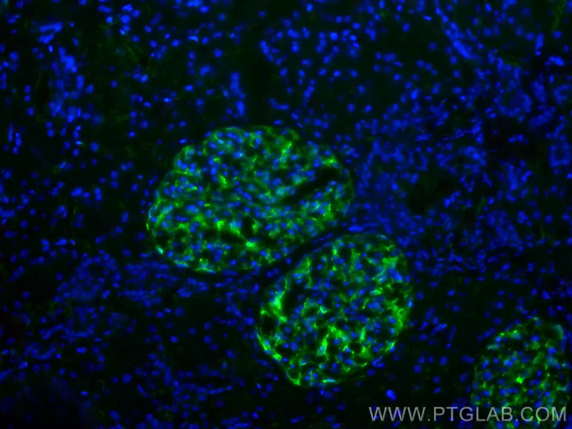 Podocalyxin antibody (68250-1-Ig) | Proteintech