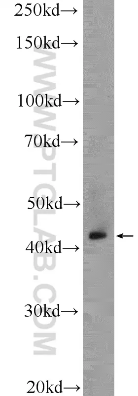 Rrm2b P53r2 Antibody 1 Ap Proteintech