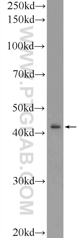 Rrm2b P53r2 Antibody 1 Ap Proteintech