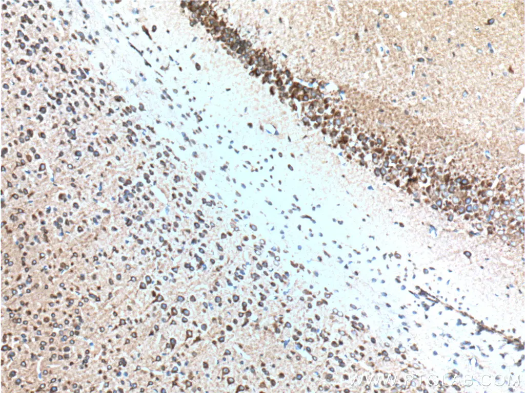 IHC staining of paraffin-embedded mouse brain tissue