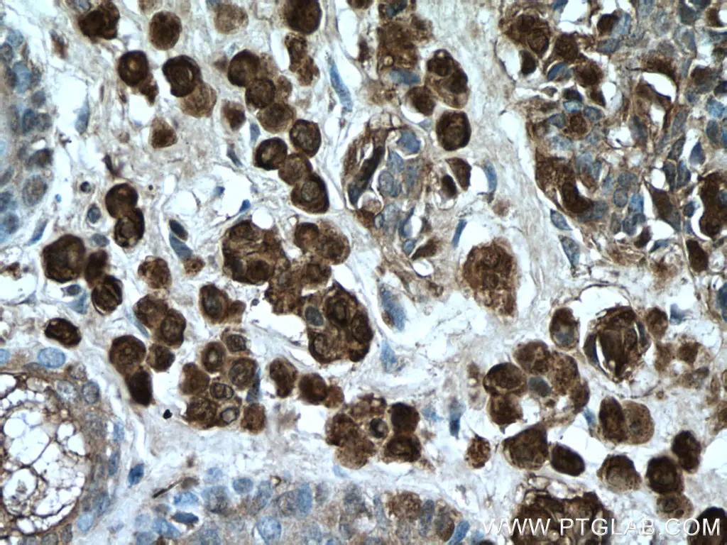 S100 Beta antibody (15146-1-AP) | Proteintech