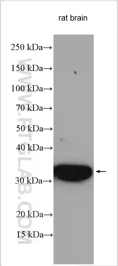 SFXN3 antibody (15156-1-AP) | Proteintech