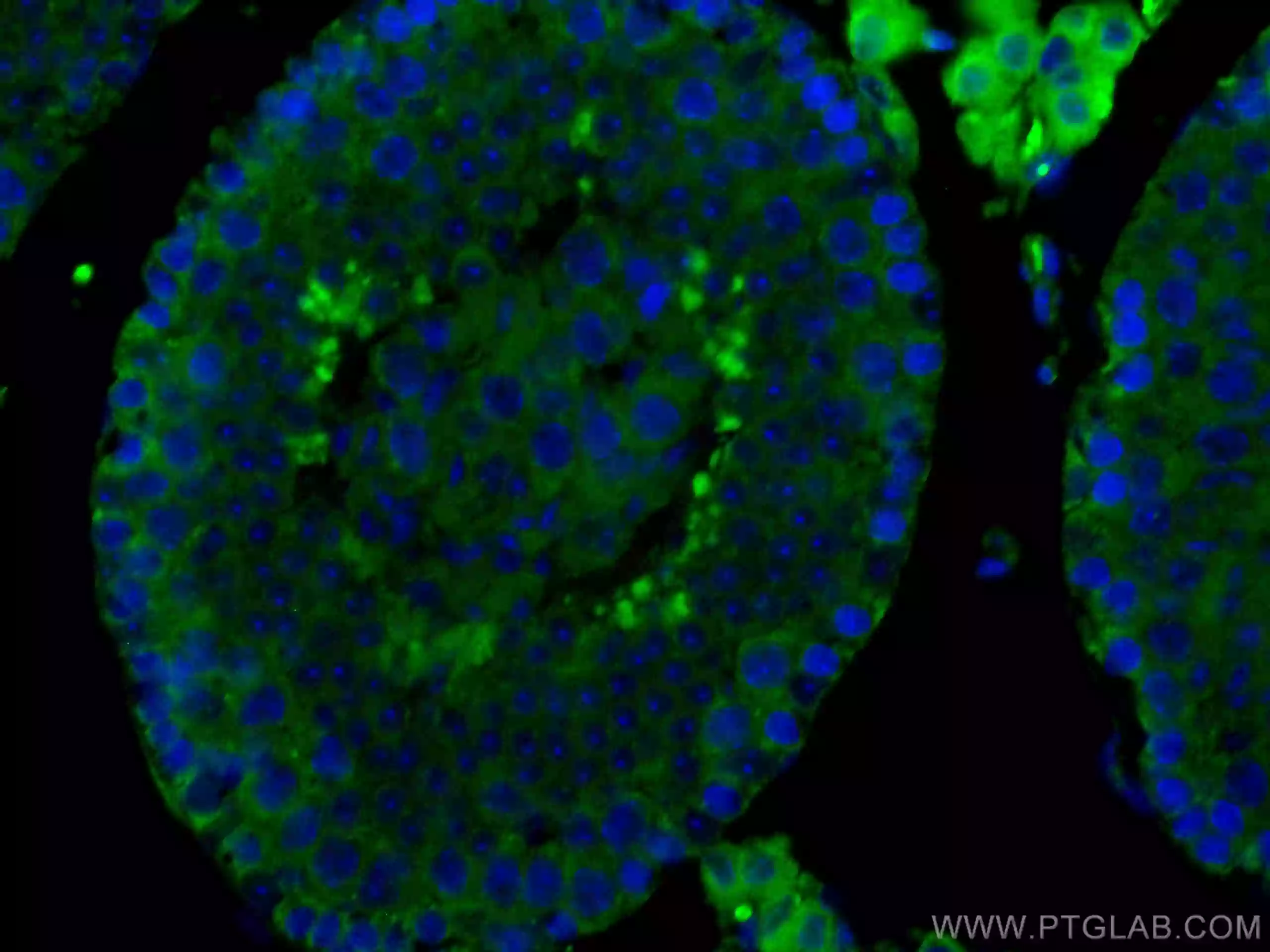 SMCR7L抗体を用いたマウス精巣組織の免疫蛍光染色像