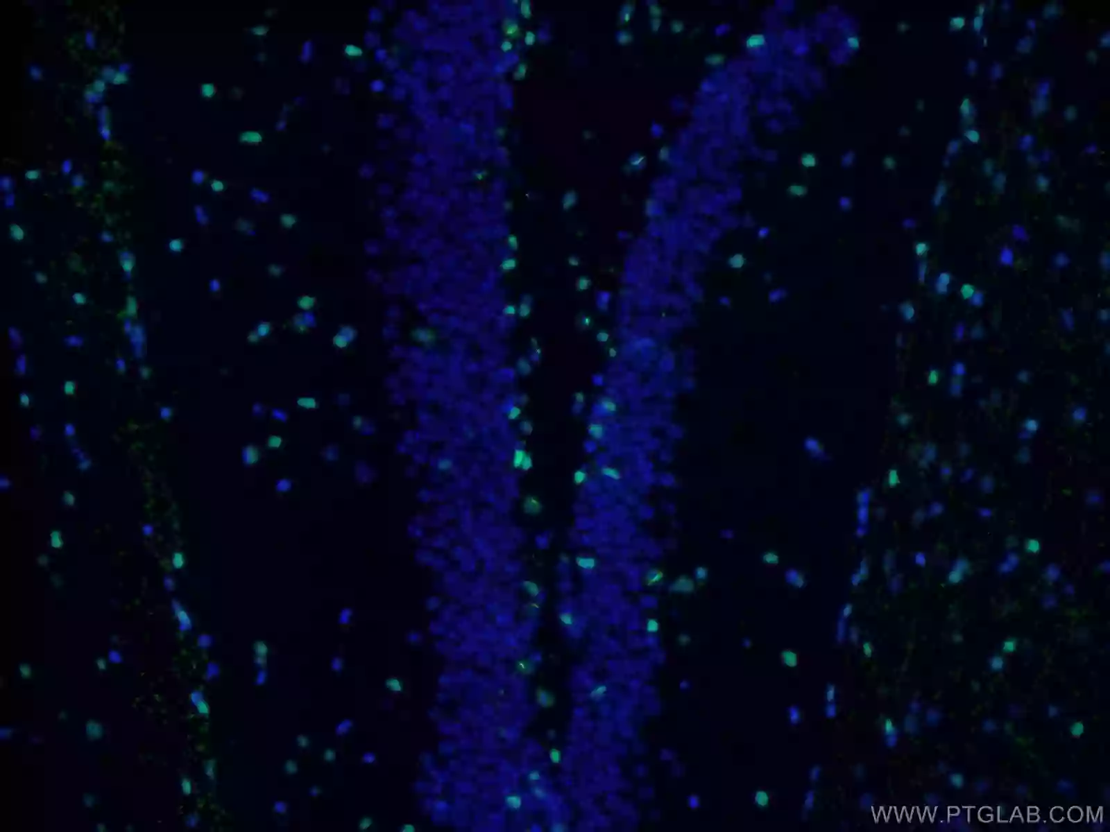 Immunofluorescent analysis of fixed mouse brain tissue using SOX2 antibody