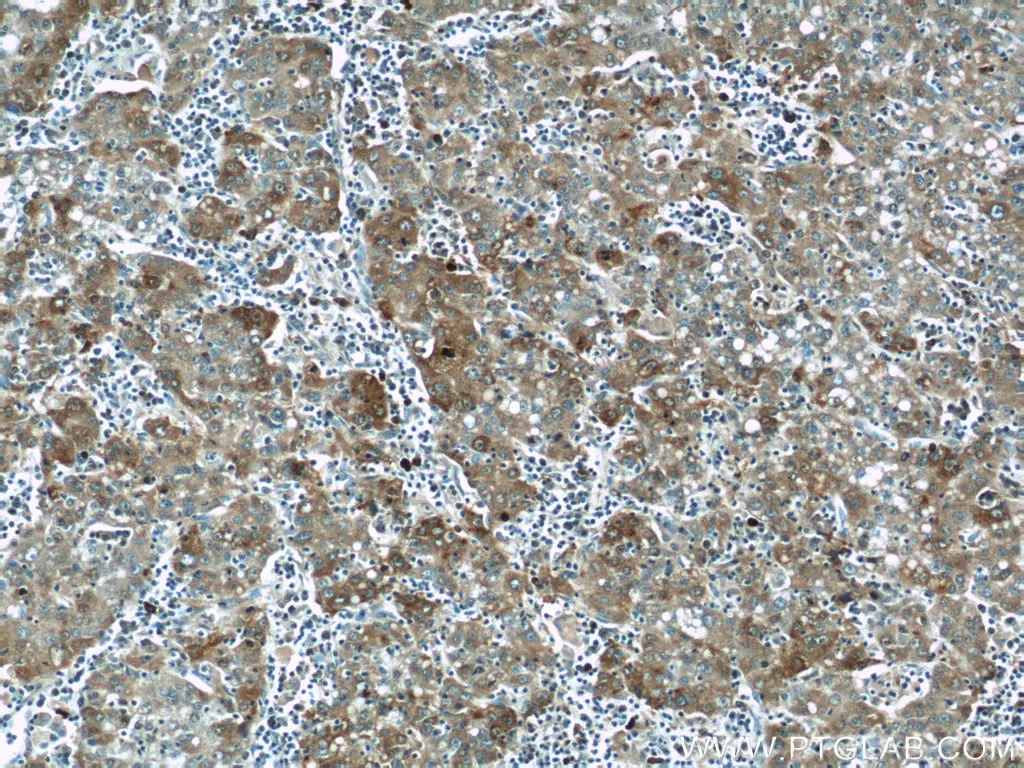 IHC analysis of paraffin-embedded human liver tissue using ATG14/Barkor (N-terminal) antibody (19491-1-AP) at a dilution of 1:200 (under 10x lens).