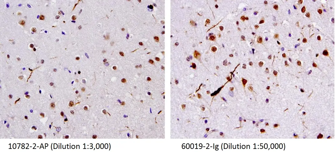 TDP43 recombinant antibody dystrophic neurites