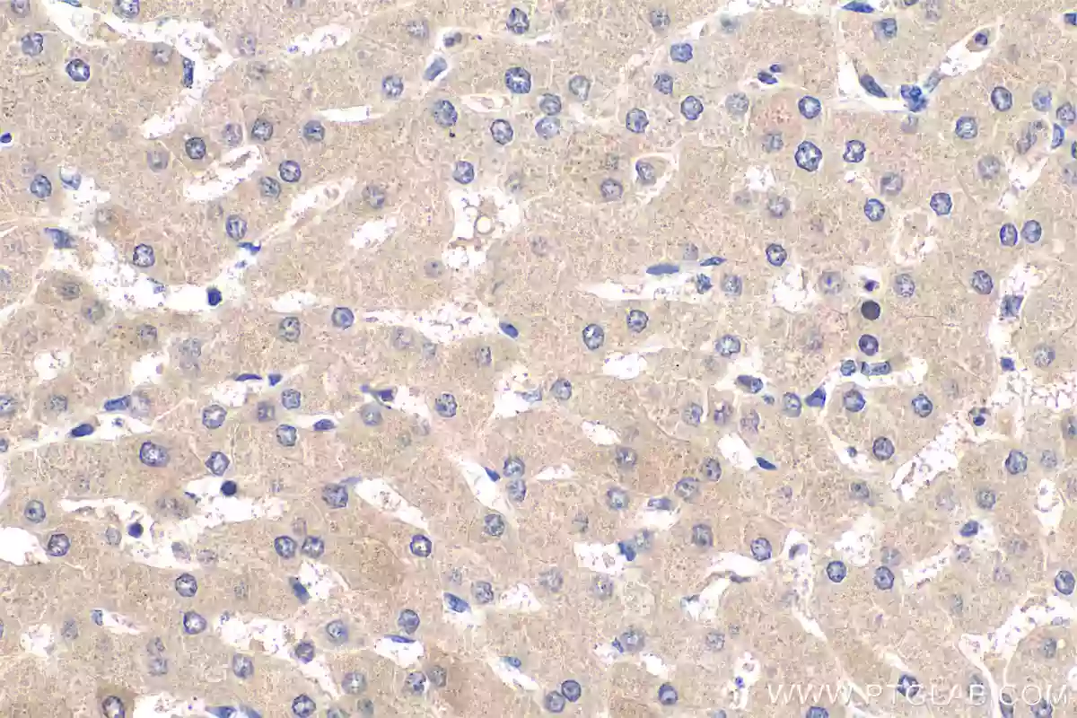 TDO2 antibody (15880-1-AP) | Proteintech