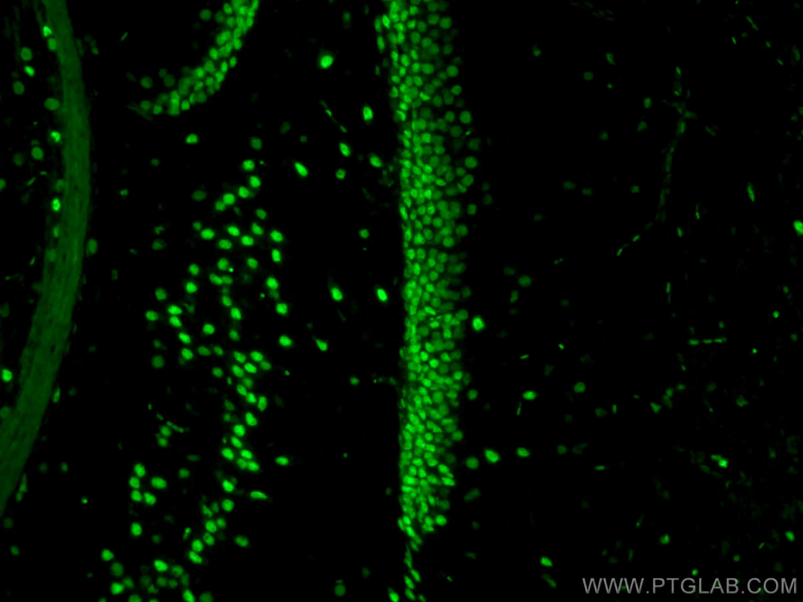 Immunofluorescent analysis of (4% PFA) fixed mouse brain tissue using CL488-80002 (TDP-43