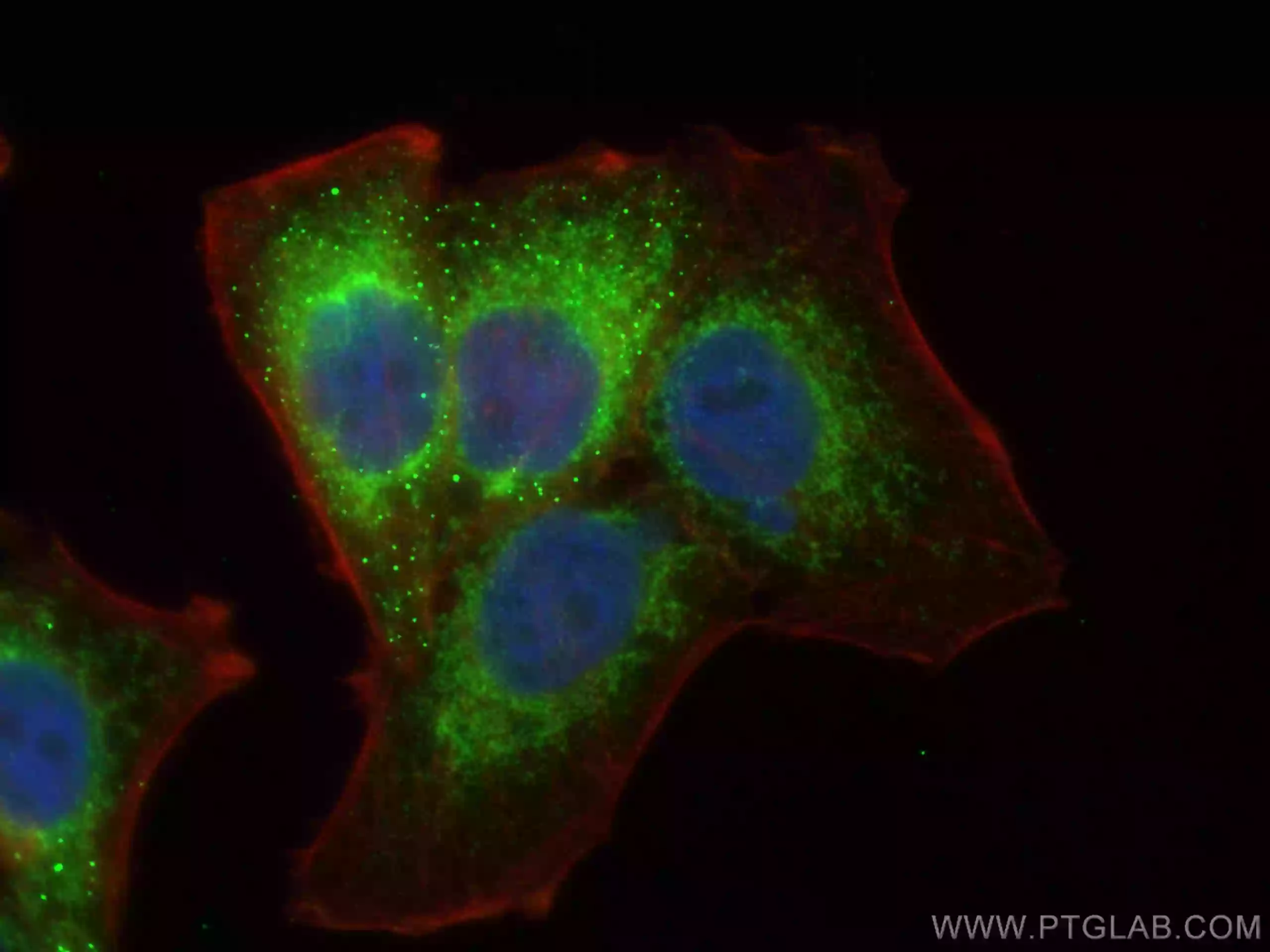 Tim23抗体を用いたHepG2細胞の免疫蛍光染色像