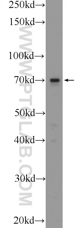 TM9SF4 antibody (25595-1-AP) | Proteintech