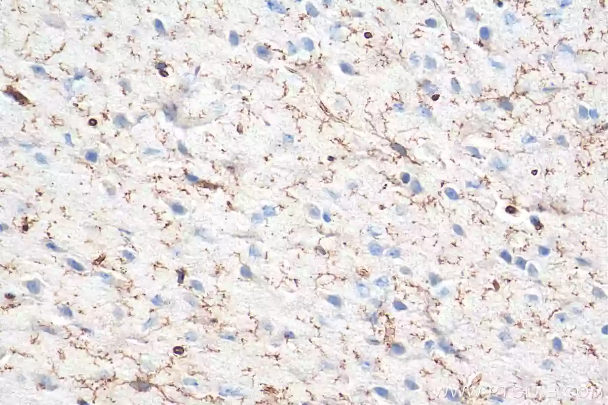 Immunohistochemical analysis of paraffin-embedded human brain tissue slide using 27585-1-AP (TMEM119 antibody) at dilution of 1:1000 (under 10x lens). Heat mediated antigen retrieval with Tris-EDTA buffer (pH 9.0).