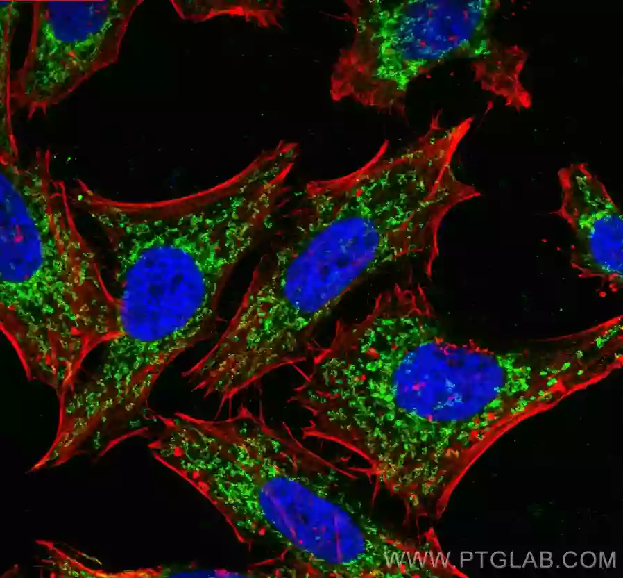 TOMM40抗体を用いたHepG2細胞の免疫蛍光染色像