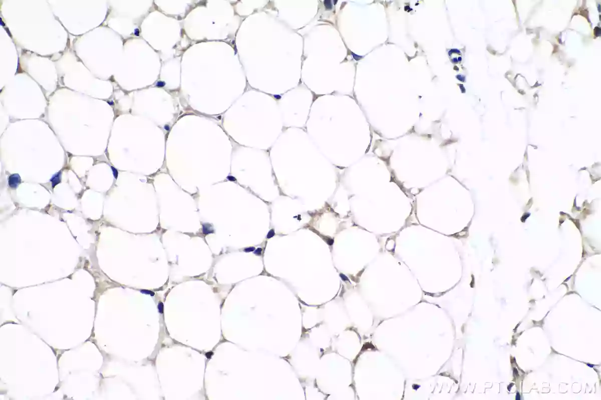 Immunohistochemical analysis of paraffin-embedded mouse brown adipose tissue slide using 23673-1-AP UCP1 antibody