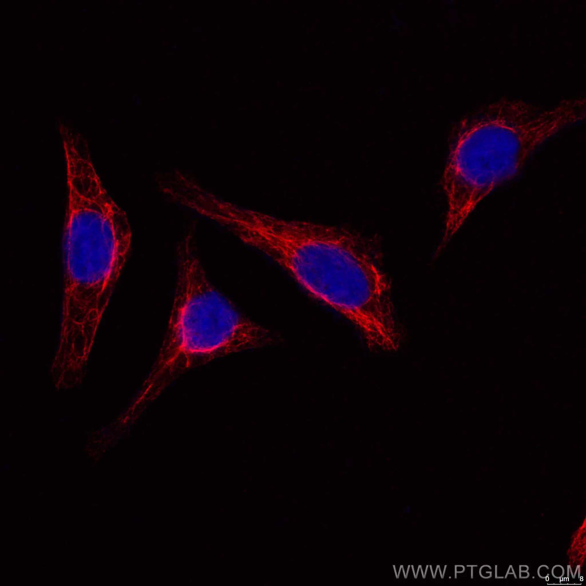 Vimentin-Antibody-CL594-60330- 