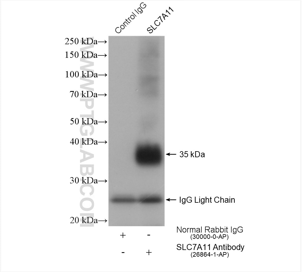 Immunoprecipitation (IP) experiment of A549 cells using SLC7A11/xCT Polyclonal antibody (26864-1-AP)