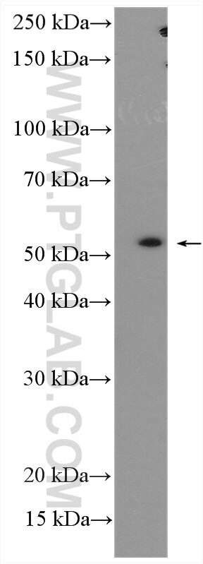 WB analysis of U2OS using 26864-1-AP