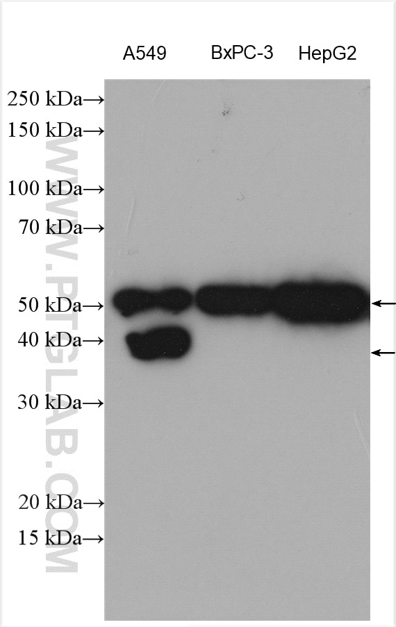 Western Blot (WB) analysis of various lysates using SLC7A11/xCT Polyclonal antibody (26864-1-AP)