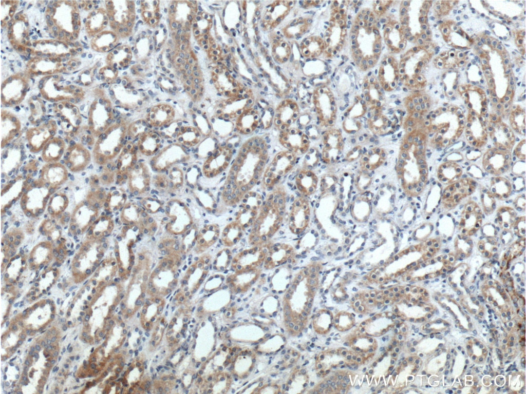 Immunohistochemistry (IHC) staining of human kidney tissue using Beta ENaC Polyclonal antibody (14134-1-AP)