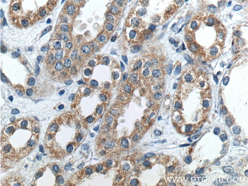 Immunohistochemistry (IHC) staining of human kidney tissue using Beta ENaC Polyclonal antibody (14134-1-AP)