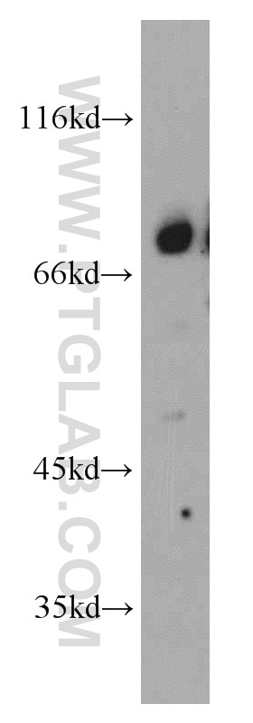 Western Blot (WB) analysis of PC-3 cells using Beta ENaC Polyclonal antibody (14134-1-AP)