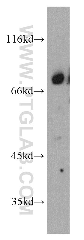 Beta ENaC Polyclonal antibody