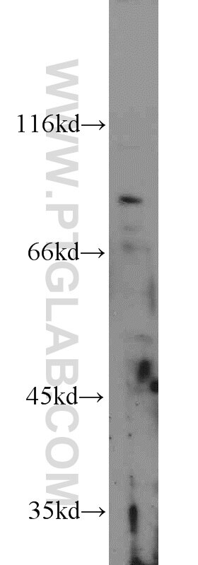 Beta ENaC