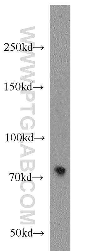 Western Blot (WB) analysis of mouse kidney tissue using Beta ENaC Polyclonal antibody (14134-1-AP)